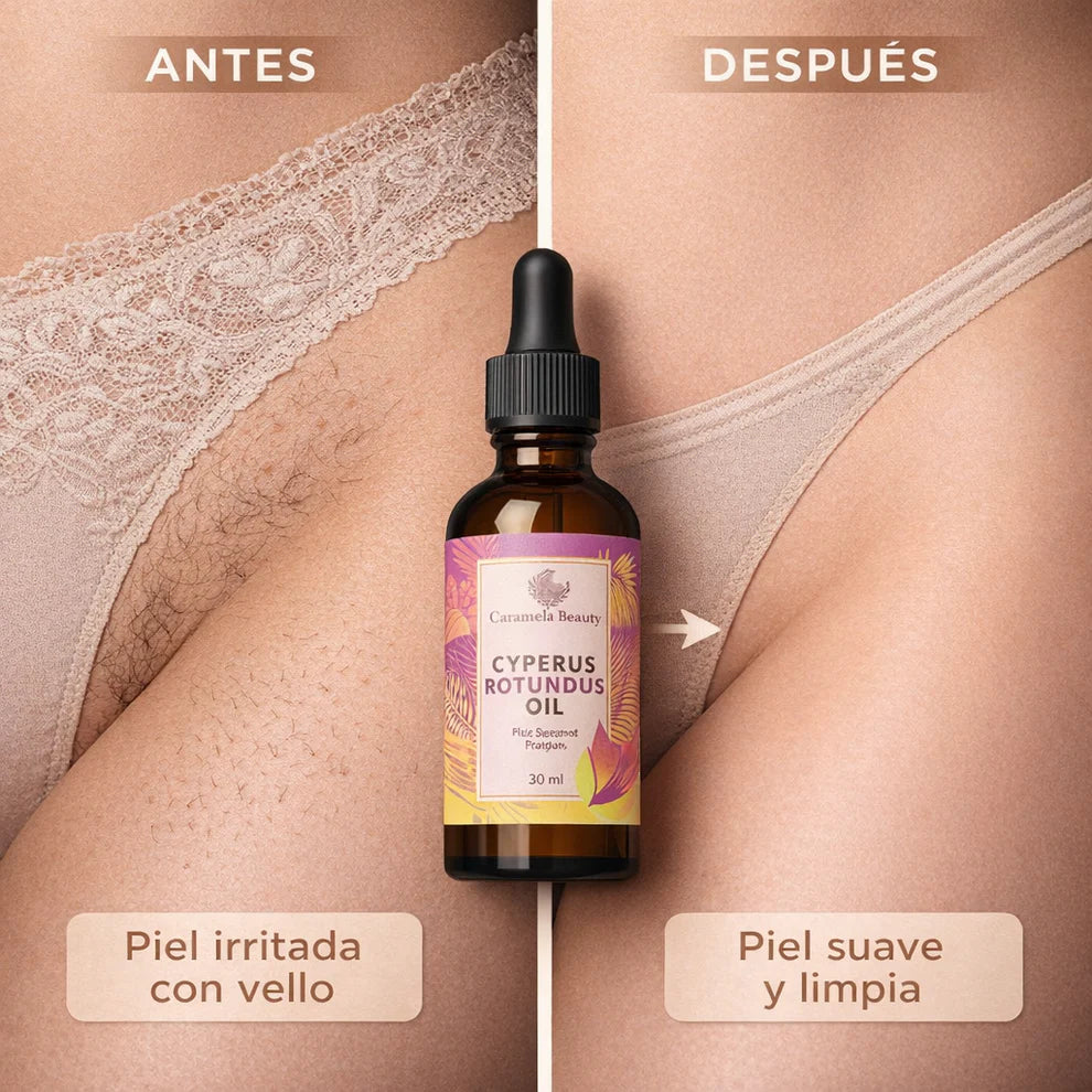 CYPERUS ROTUNDUS: Reduce el crecimiento del vello